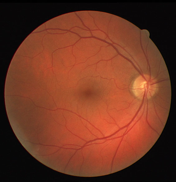 Retinal image